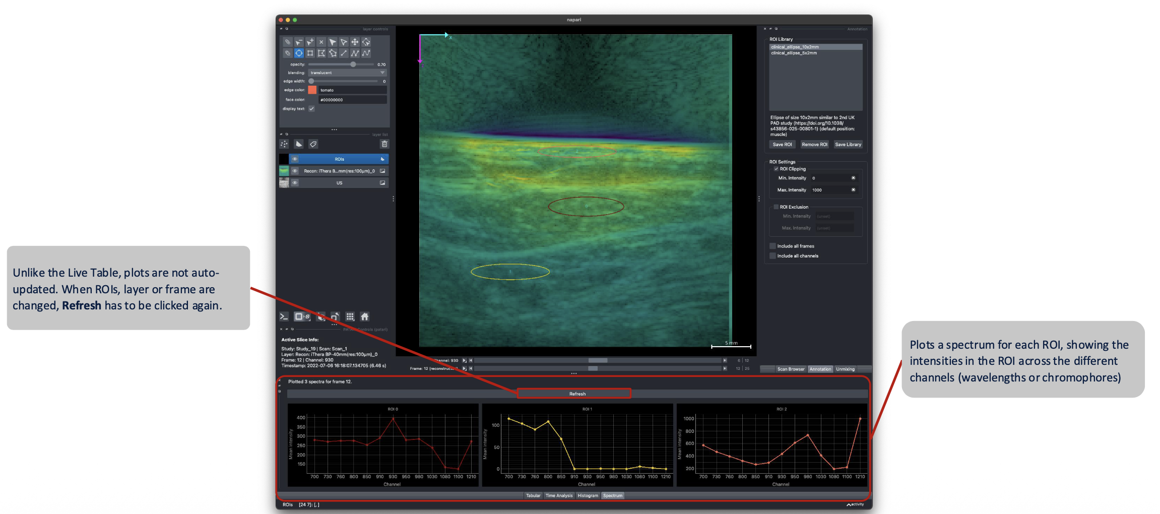 Spectra Analysis